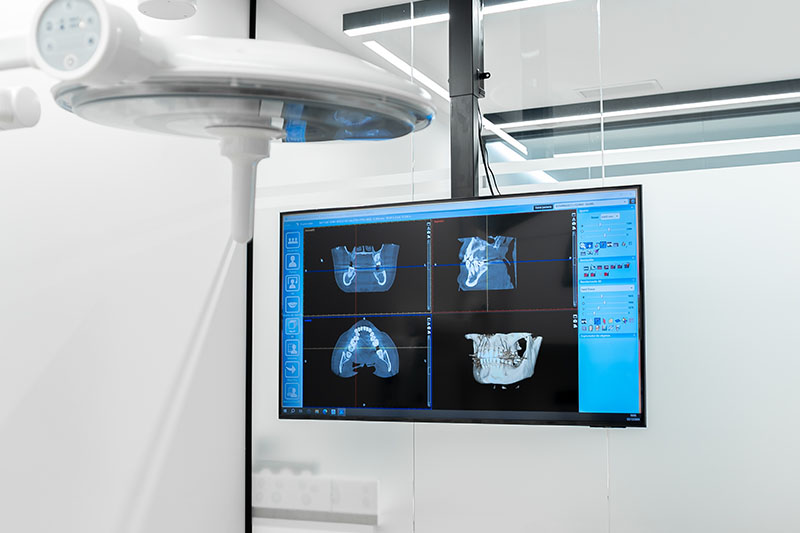 Clínica dental en Zaragoza Clínica dental en Zaragoza