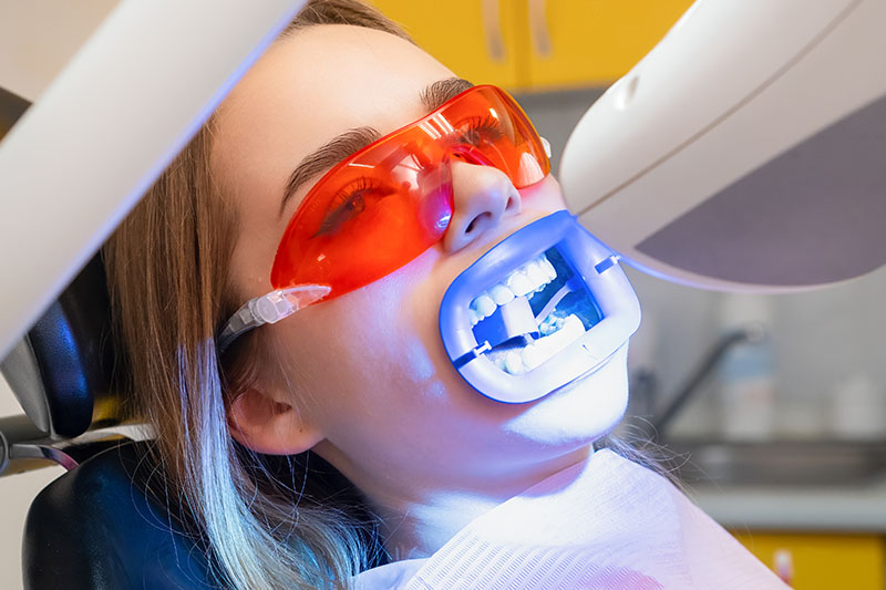 Blanqueamiento dental en Zaragoza