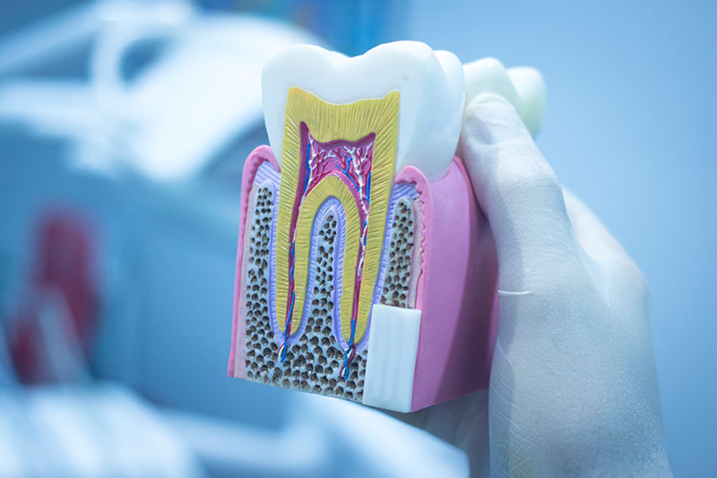 Endodoncia en Zaragoza Endodoncia en Zaragoza
