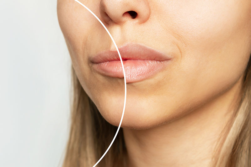 Estética facial en Zaragoza Estética facial en Zaragoza