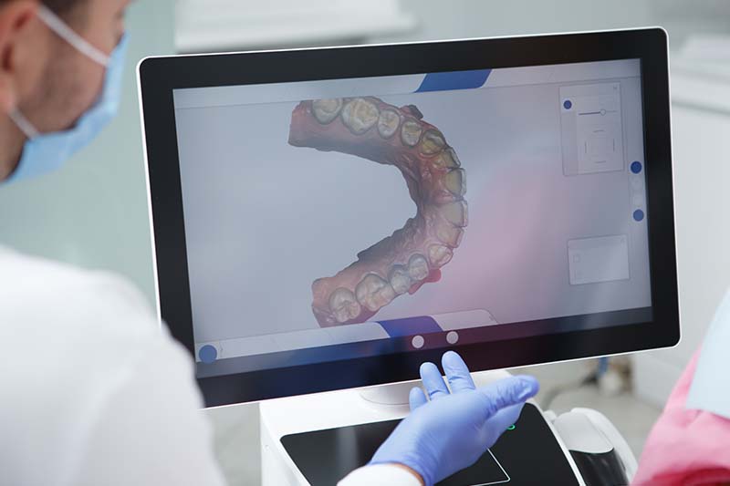 Odontología conservadora en Zaragoza Odontología conservadora en Zaragoza