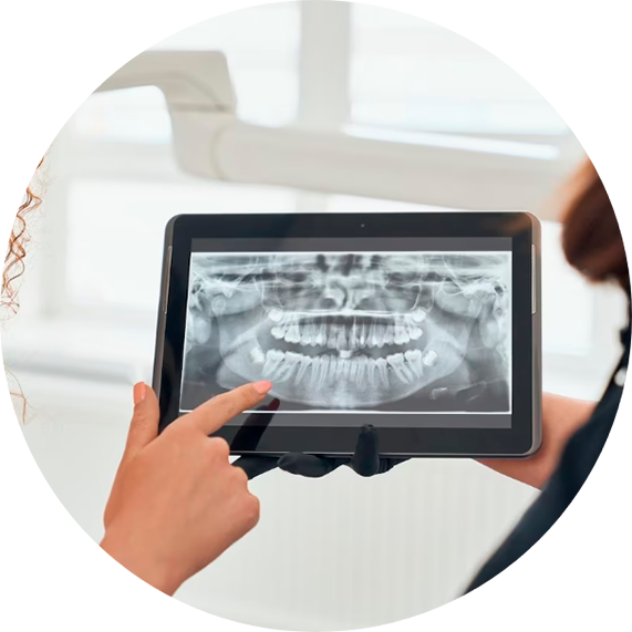 Invisalign en Zaragoza Invisalign en Zaragoza
