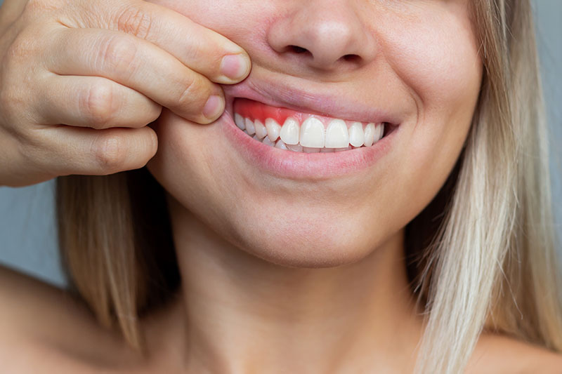 Periodoncia en Zaragoza Periodoncia en Zaragoza