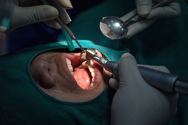 Periodoncia en Zaragoza Periodoncia en Zaragoza